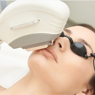 Facial Laser